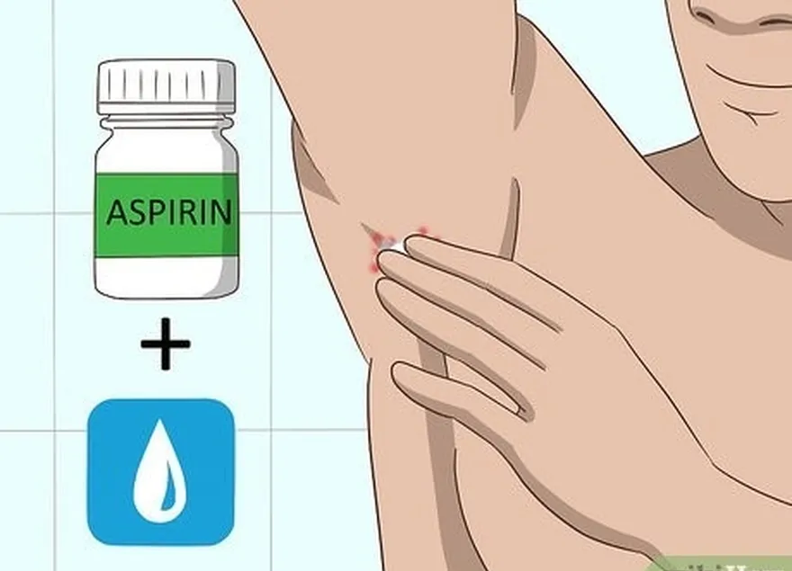 8-qadam, boshqa muolajalar uchun alternativa sifatida ho'l aspirinni ushlang.